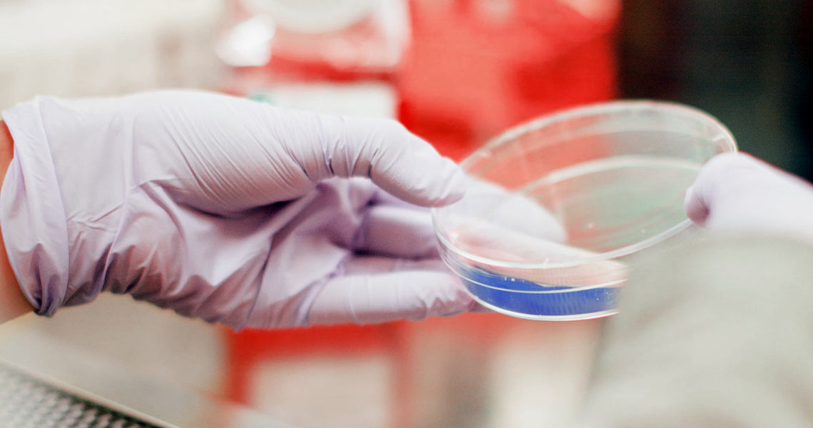 hands in laboratory gloves holding petri dish - symbol image